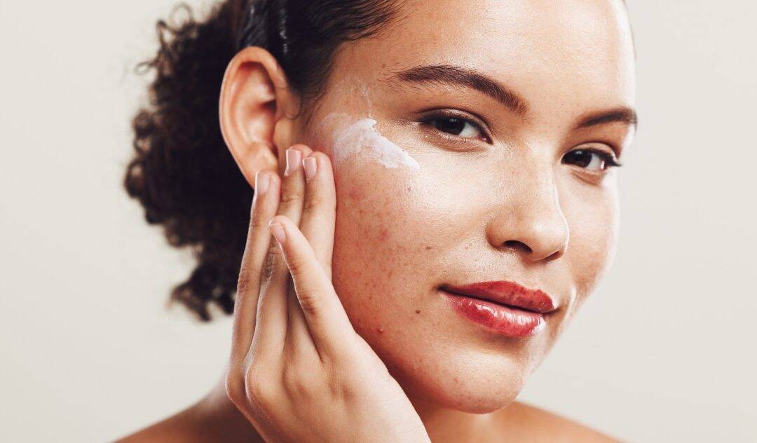 Kako se riješiti akni: najčešći uzroci i učinkovita rješenja